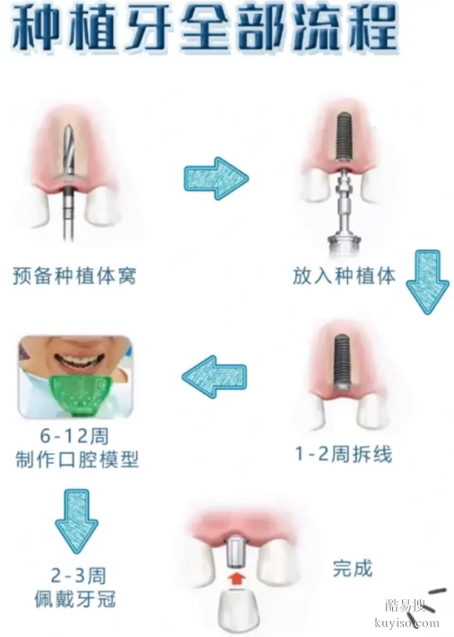 口腔種植牙一般要多少錢
