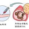 丹東產(chǎn)前親子鑒定結(jié)果跟生之后結(jié)果一樣嗎-2025價格表