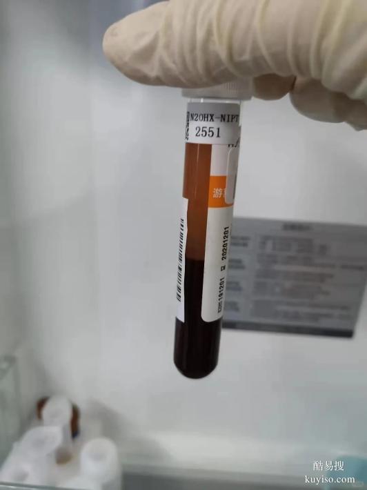 邯鄲親子鑒定指南：指甲準(zhǔn)確率全流程解析指甲-正規(guī)dna鑒定中心