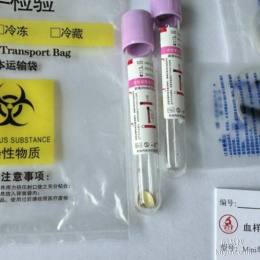 泉州親子鑒定dna多少錢？價格標準（需要什么材料）