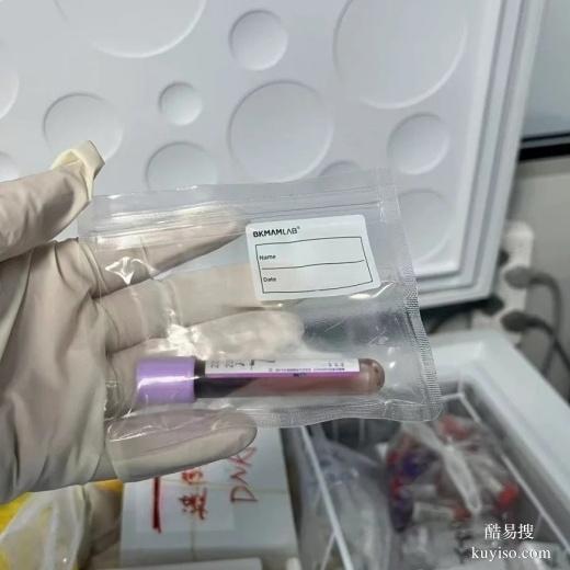 泉州親子鑒定結(jié)果，支持或者排插兩項(xiàng)（親緣關(guān)系確認(rèn)）