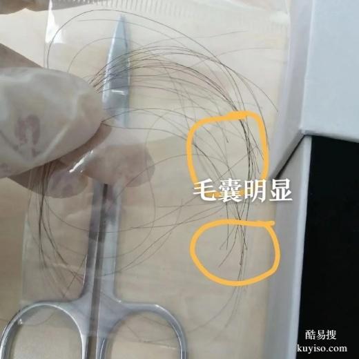 泉州親子鑒定結(jié)果，支持或者排插兩項(xiàng)（親緣關(guān)系確認(rèn)）